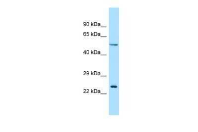 Western Blot: RAB30 Antibody [NBP3-09500]