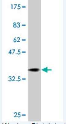 Western Blot: RAB31 Antibody (1C6) [H00011031-M01]