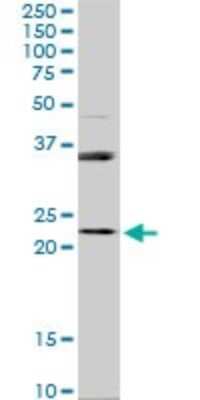 Western Blot: RAB31 Antibody (4D12) [H00011031-M03]