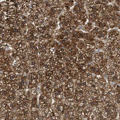 Immunohistochemistry-Paraffin: RAB31 Antibody [NBP1-80859]