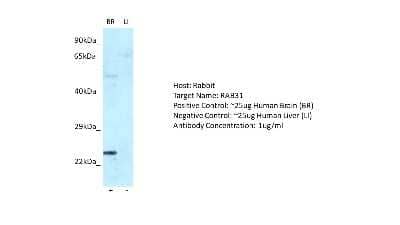 Western Blot: RAB31 Antibody [NBP1-79921]