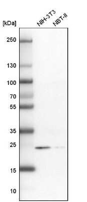 Western Blot: RAB31 Antibody [NBP1-80859]
