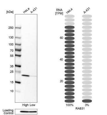 Western Blot: RAB31 Antibody [NBP1-80859]