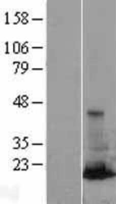 Western Blot: RAB31 Overexpression Lysate [NBL1-15060]