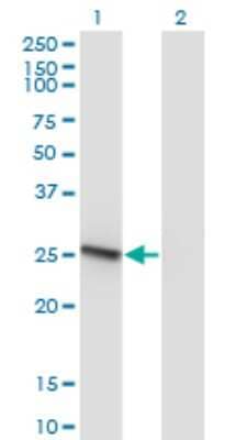 Western Blot: RAB32 Antibody (1C7) [H00010981-M01]