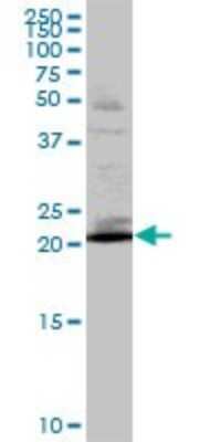 Western Blot: RAB32 Antibody [H00010981-B01P]