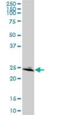 Western Blot: RAB32 Antibody [H00010981-B01P]