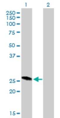 Western Blot: RAB32 Antibody [H00010981-B01P]