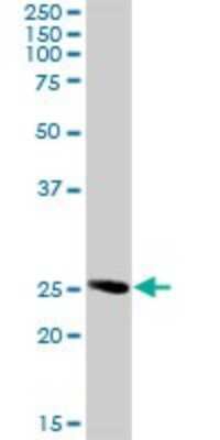 Western Blot: RAB32 Antibody [H00010981-D01P]