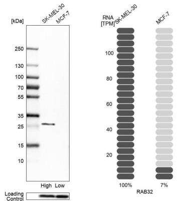 Western Blot: RAB32 Antibody [NBP1-85968]