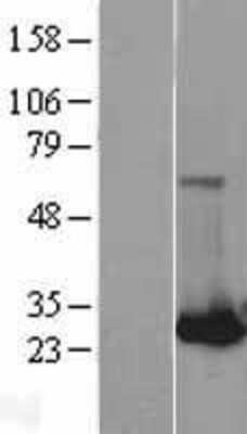 Western Blot: RAB32 Overexpression Lysate [NBL1-15061]