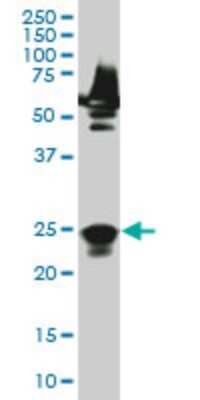 Western Blot: RAB33A Antibody (8A11) [H00009363-M04]