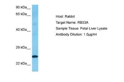 Western Blot: RAB33A Antibody [NBP2-85574]