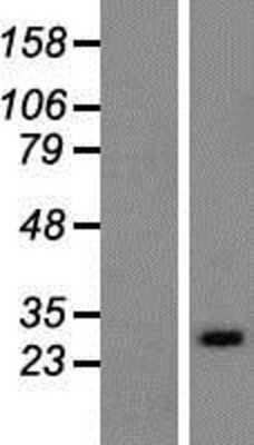 Western Blot: RAB33A Overexpression Lysate [NBP2-07826]