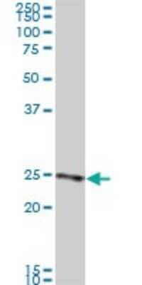 Western Blot: RAB33B Antibody (6F4) [H00083452-M01]