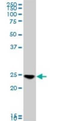 Western Blot: RAB33B Antibody (6F4) [H00083452-M01]