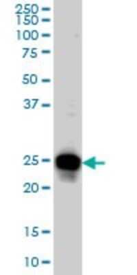 Western Blot: RAB33B Antibody (6F4) [H00083452-M01]