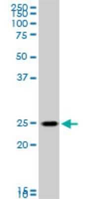 Western Blot: RAB33B Antibody (6F4) [H00083452-M01]