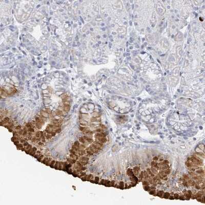 Immunohistochemistry-Paraffin: RAB33B Antibody [NBP2-13191]