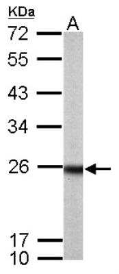 Western Blot: RAB33B Antibody [NBP2-20041]