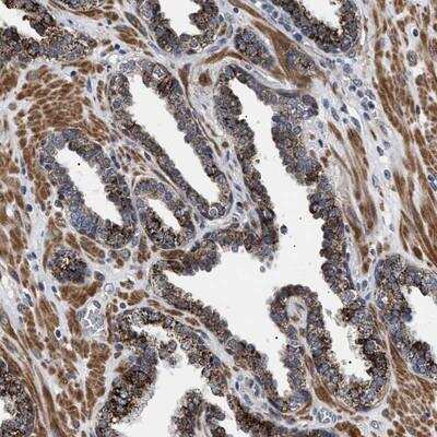 Immunohistochemistry: RAB34 Antibody [NBP1-87177]