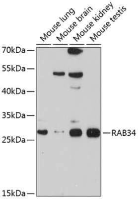 Western Blot: RAB34 AntibodyBSA Free [NBP2-93447]