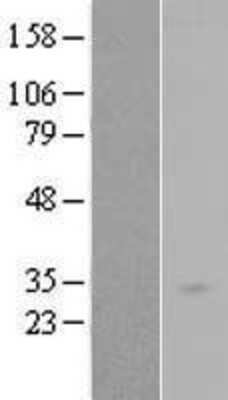 Western Blot: RAB34 Overexpression Lysate [NBL1-15063]