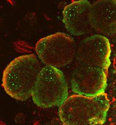 Immunocytochemistry/ Immunofluorescence: RAB35 Antibody [NBP1-79484]