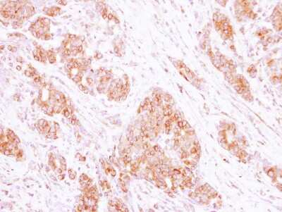 Immunohistochemistry-Paraffin: RAB35 Antibody [NBP2-20042]