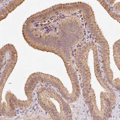 Immunohistochemistry-Paraffin: RAB35 Antibody [NBP2-49120]