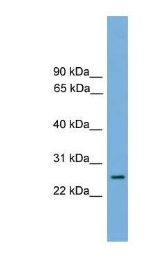 Western Blot: RAB35 Antibody [NBP1-79484]