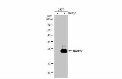Western Blot: RAB35 Antibody [NBP2-20042]