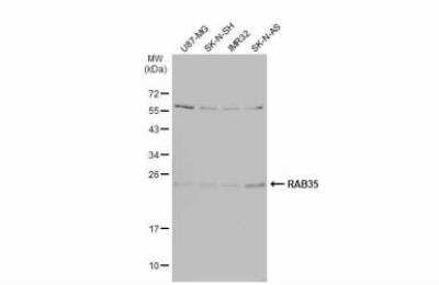 Western Blot: RAB35 Antibody [NBP2-20042]