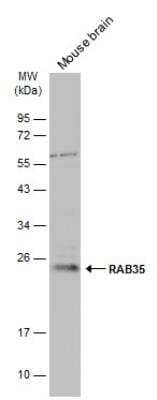 Western Blot: RAB35 Antibody [NBP2-20042]