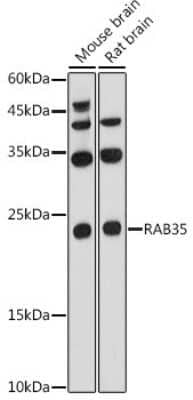 Western Blot: RAB35 AntibodyAzide and BSA Free [NBP3-04511]