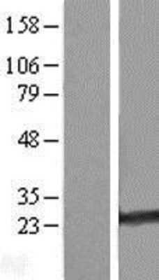 Western Blot: RAB35 Overexpression Lysate [NBL1-15064]