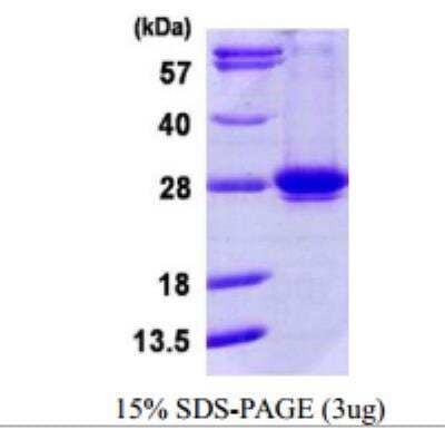 SDS-PAGE: Recombinant Human RAB35 His Protein [NBP1-72460]