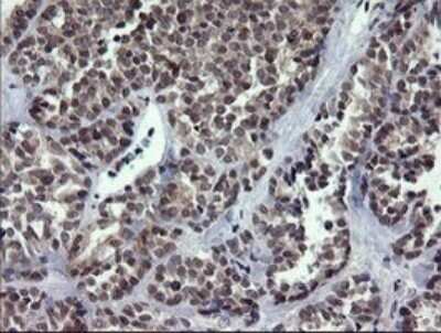Immunohistochemistry: RAB37 Antibody (OTI2F1) - Azide and BSA Free [NBP2-73772]