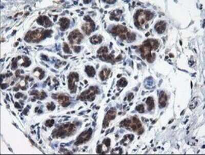 Immunohistochemistry: RAB37 Antibody (OTI2F1) - Azide and BSA Free [NBP2-73772]