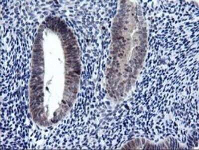 Immunohistochemistry: RAB37 Antibody (OTI2F1) - Azide and BSA Free [NBP2-73772]