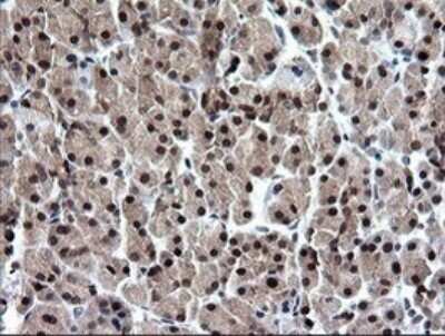 Immunohistochemistry: RAB37 Antibody (OTI2F1) - Azide and BSA Free [NBP2-73772]