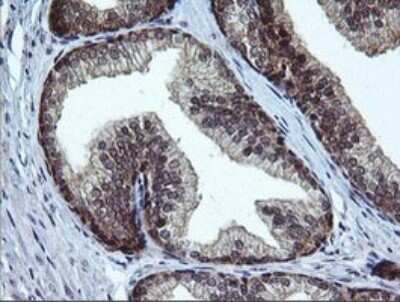 Immunohistochemistry: RAB37 Antibody (OTI2F1) - Azide and BSA Free [NBP2-73772]