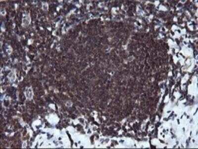 Immunohistochemistry: RAB37 Antibody (OTI2F1) - Azide and BSA Free [NBP2-73772]