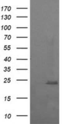 Western Blot: RAB37 Antibody (OTI2F1)Azide and BSA Free [NBP2-73772]