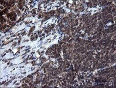 Immunohistochemistry: RAB37 Antibody (OTI2F1) [NBP2-45926]