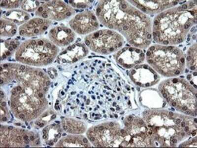 Immunohistochemistry: RAB37 Antibody (OTI2F1) [NBP2-45926]