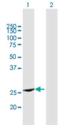 Western Blot: RAB37 Antibody [H00326624-B01P]