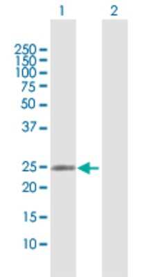 Western Blot: RAB37 Antibody [H00326624-D01P]