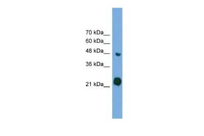 Western Blot: RAB37 Antibody [NBP2-82324]