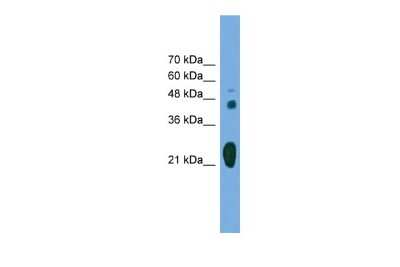 Western Blot: RAB37 Antibody [NBP2-82325]